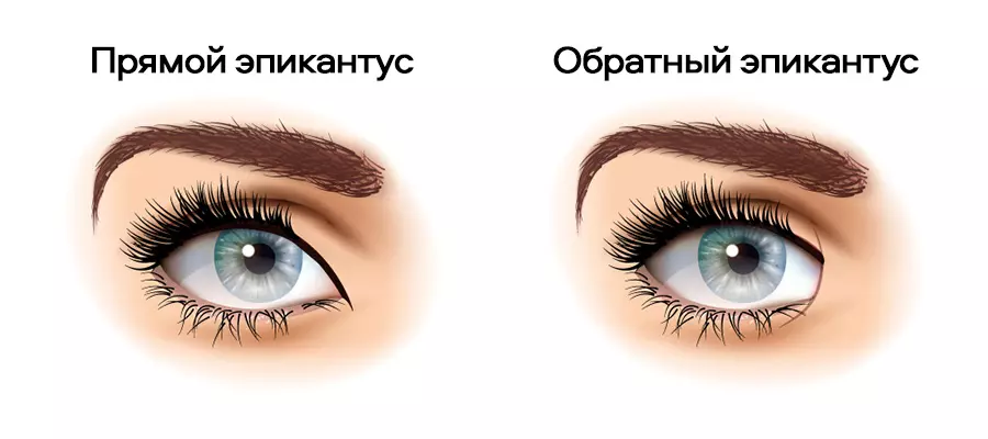 Эпикантус: что это такое и почему возникает третье веко