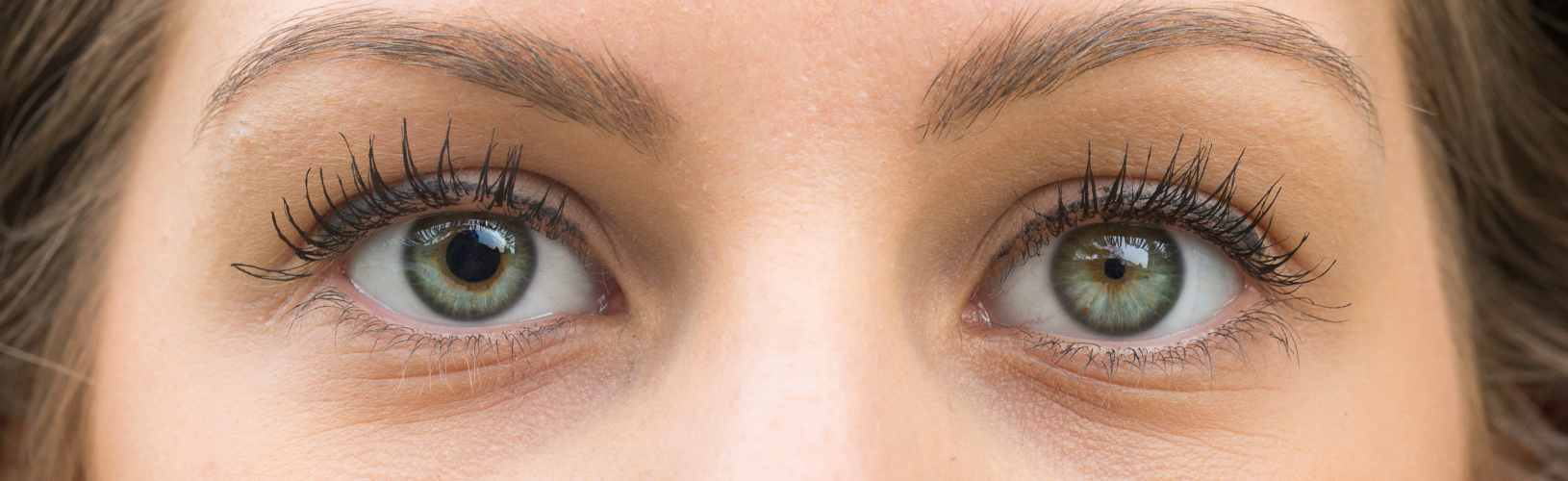 Анизокория