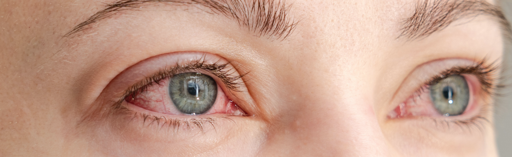 Ребенок часто моргает: причины, возможные заболевания и когда стоит обращаться к врачу