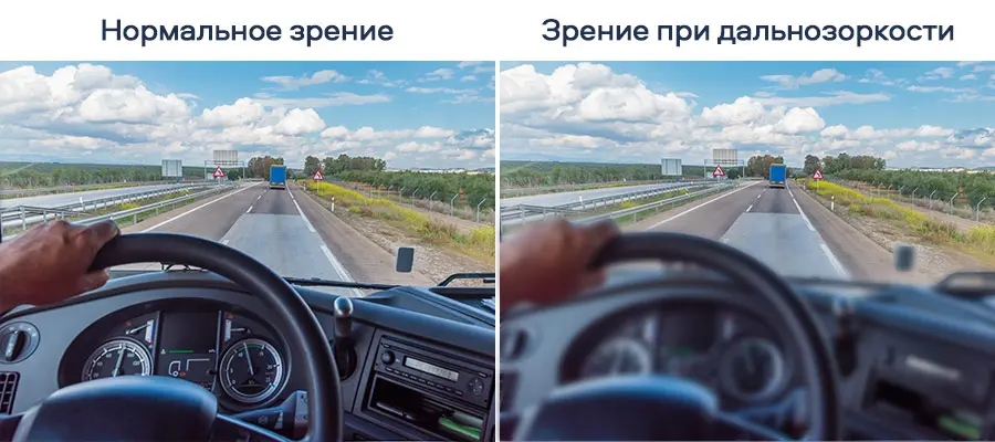 Контактные линзы при дальнозоркости