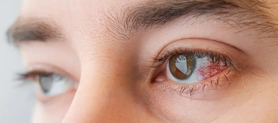 Гиалуроновые капли для глаз