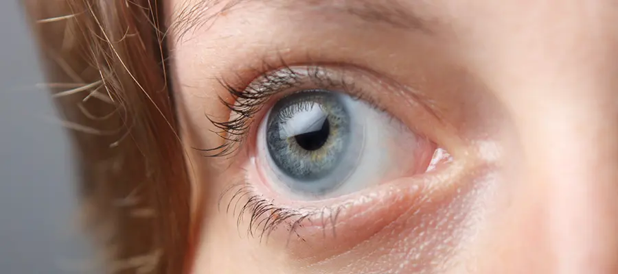 Выбор линз по типу зрения