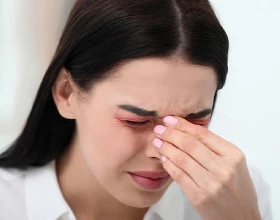 Как убрать покраснение глаз