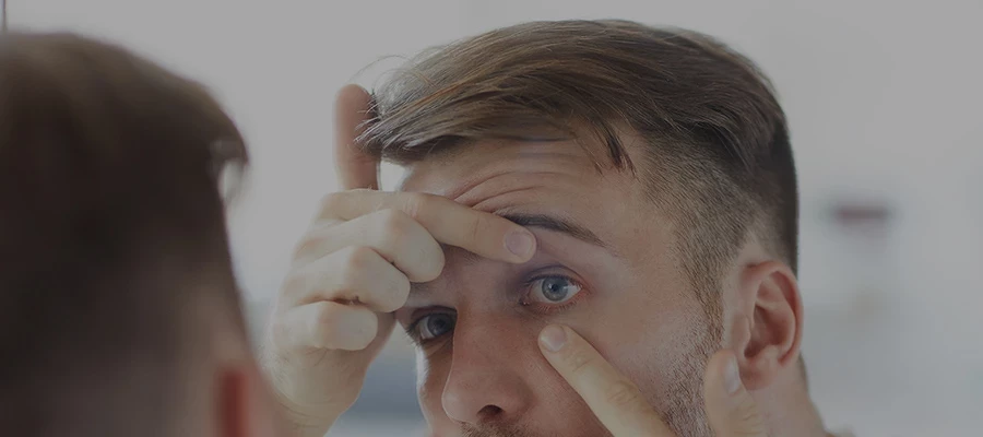 Аллергия на контактные линзы