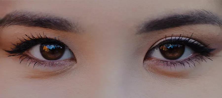 Эпикантус: что это такое и почему возникает третье веко