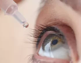 Кератит: симптомы и лечение