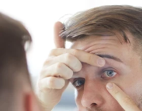 Аллергия на контактные линзы