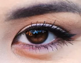 Эпикантус: что это такое и почему возникает третье веко