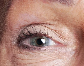 Контактные линзы после 45 лет